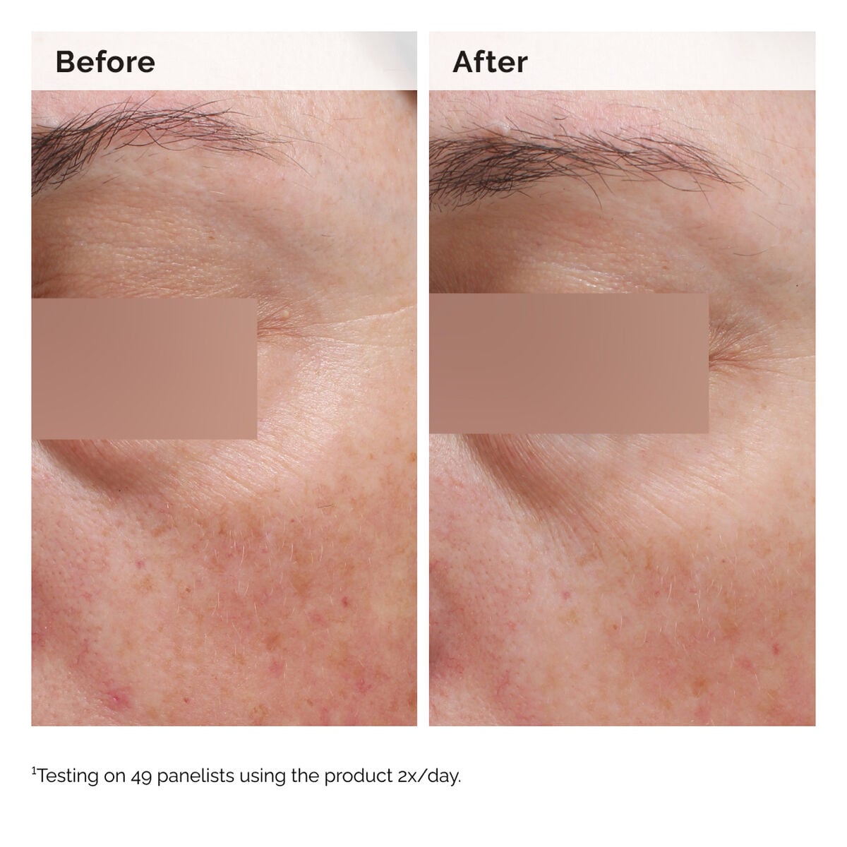 niacinamide-5-face-and-body-emulsion-j9 2024-08-23-ORD-Nia-5pct-Face-Body-B-A-Elasticity-Global-02-1x1.jpg