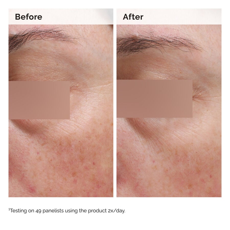niacinamide-5-face-and-body-emulsion-j9 2024-08-23-ORD-Nia-5pct-Face-Body-B-A-Elasticity-Global-02-1x1.jpg