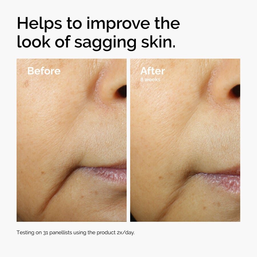 caffeine-3-escin-1-face-serum-q1 ord-caffeine-3pct-escin-1pct-face-serum-before-after-sagging.jpg