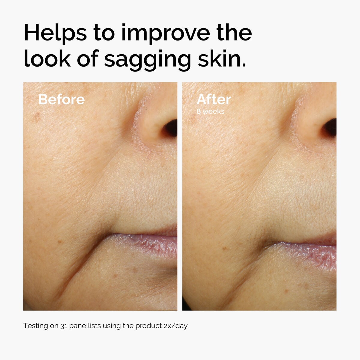 caffeine-3-escin-1-face-serum-q1 ord-caffeine-3pct-escin-1pct-face-serum-before-after-sagging.jpg