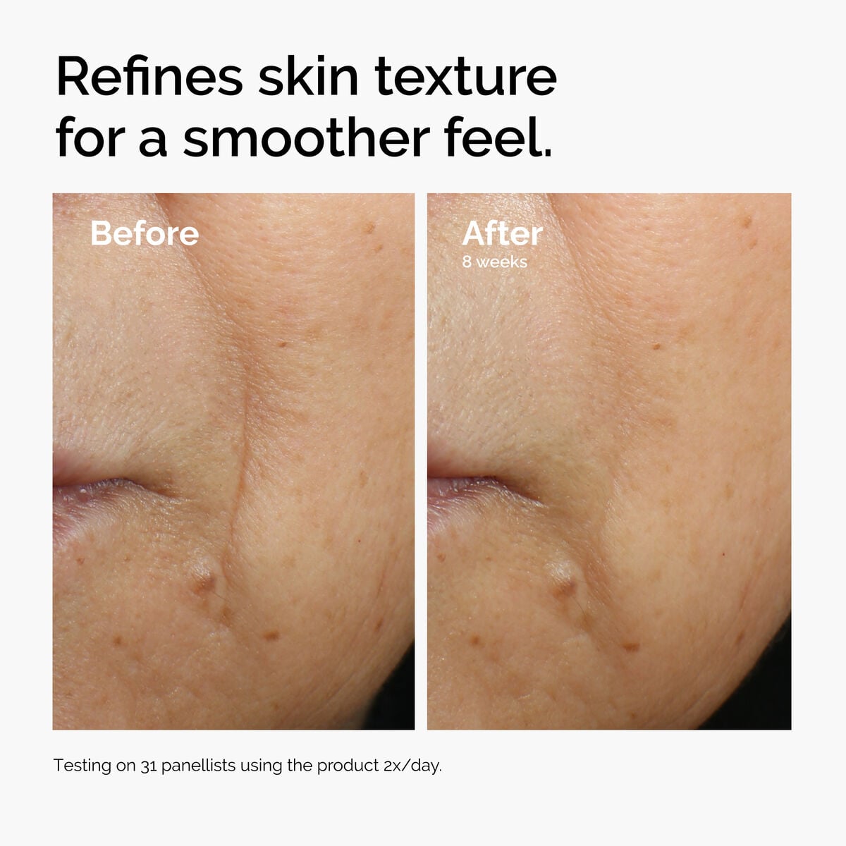 caffeine-3-escin-1-face-serum-q1 ord-caffeine-3pct-escin-1pct-face-serum-before-after-texture.jpg