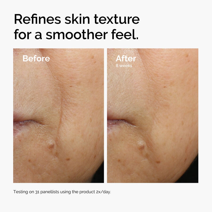 caffeine-3-escin-1-face-serum-q1 ord-caffeine-3pct-escin-1pct-face-serum-before-after-texture.jpg