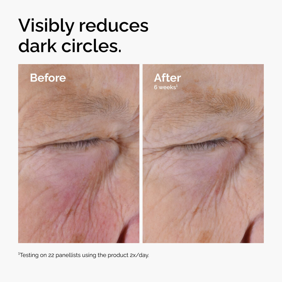 caffeine-solution-5-egcg-eye-serum-d0 ord-caffeine-solution-egcg-dark-circles-before-after.jpg