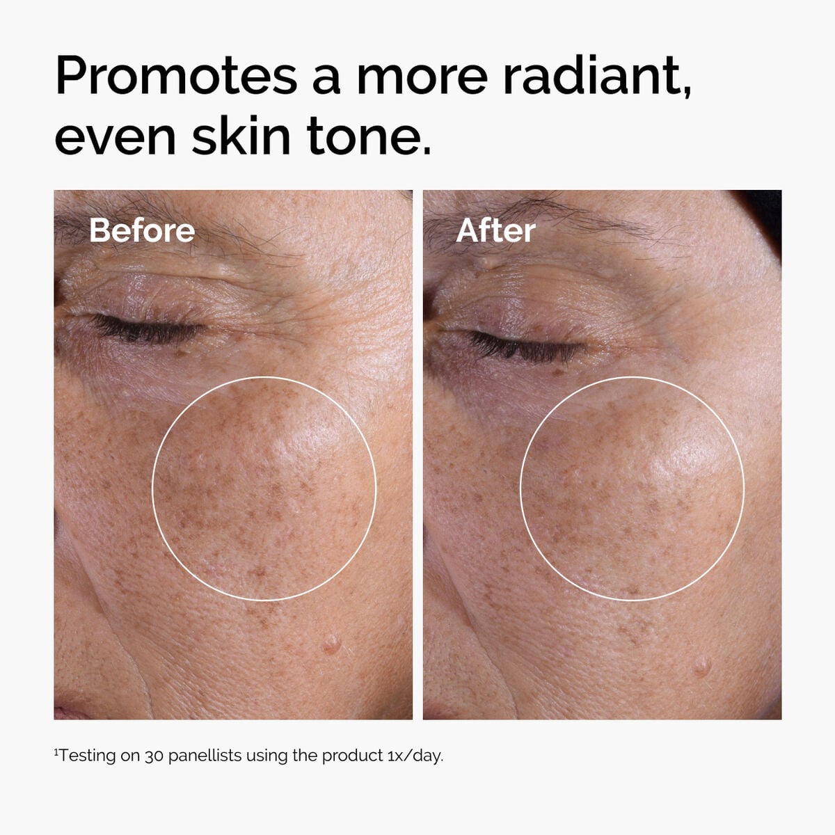 glycolic-acid-7-exfoliating-toner-e8 ord-glycolic-before-after-radiance.jpg