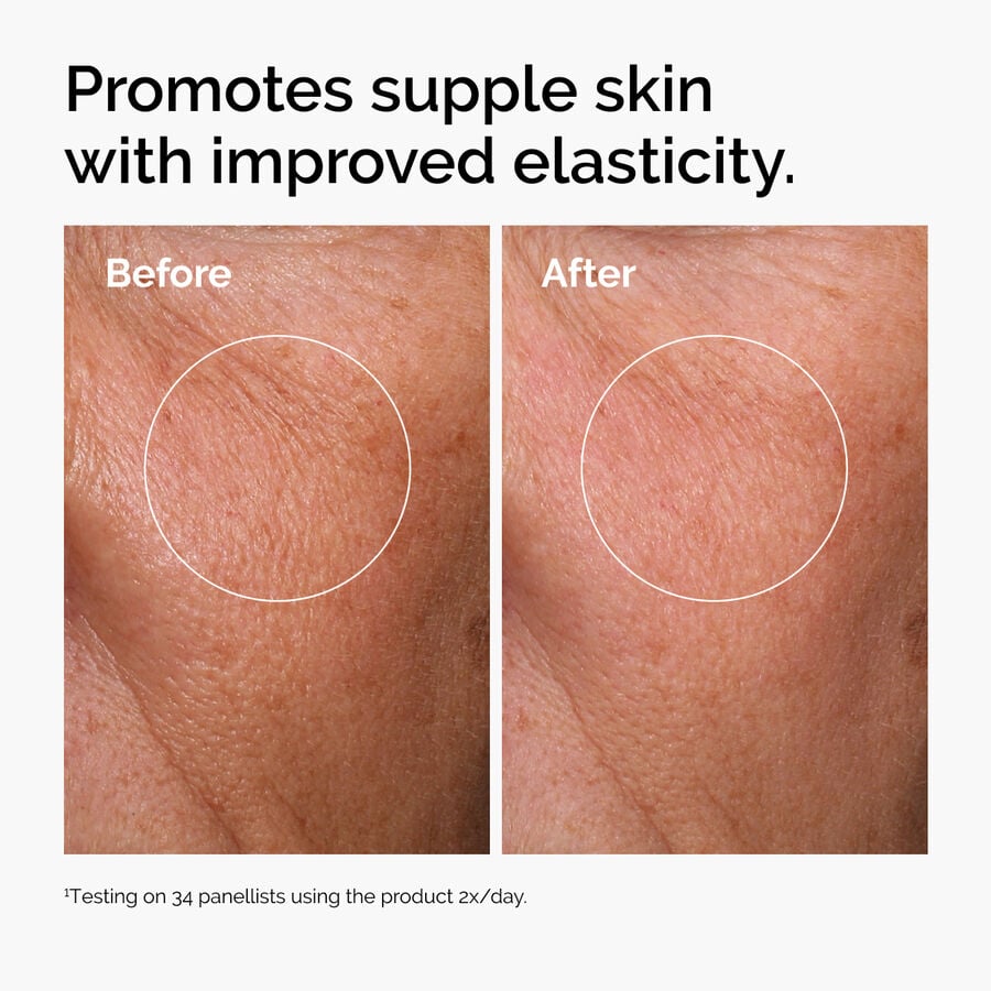 hyaluronic-acid-2-b5-with-ceramides-x1 ord-hyaluronic-acid-2pct-b5-hydrating-serum-before-after-elasticity.jpg