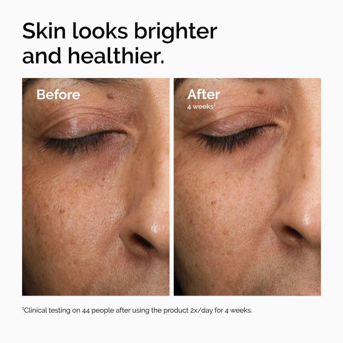 multi-antioxidant-radiance-serum-c6 ord-mars-before-after-healthy.jpg