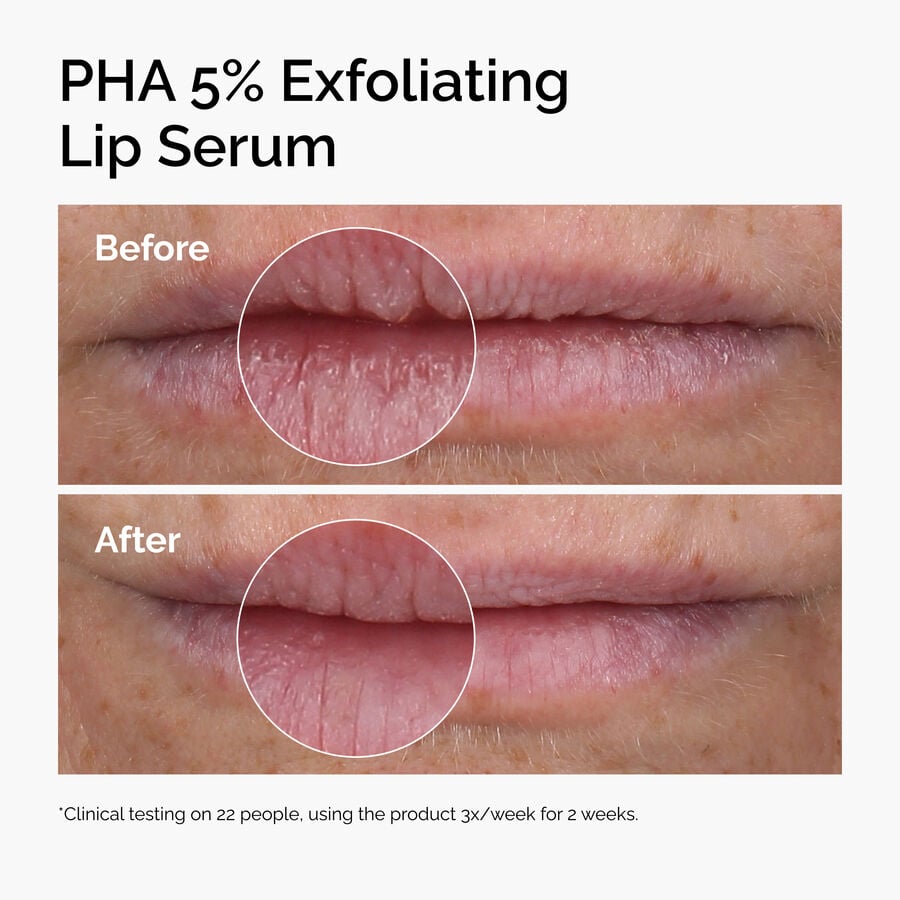 pha-5-exfoliating-lip-serum-j3 ord-pha-5pct-lip-exfoliating-serum-before-after.jpg