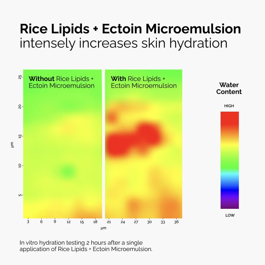 rice-lipids-ectoin-microemulsion-e6 ord-rice-lipids-ectoin-microemulsion-thermal-before-after.jpg
