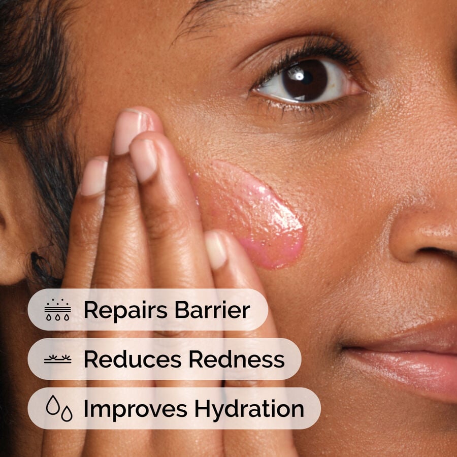 soothing-and-barrier-support-serum-set-x3 ord-soothing-barrier-support-serum-model-application-with-benefits.jpg